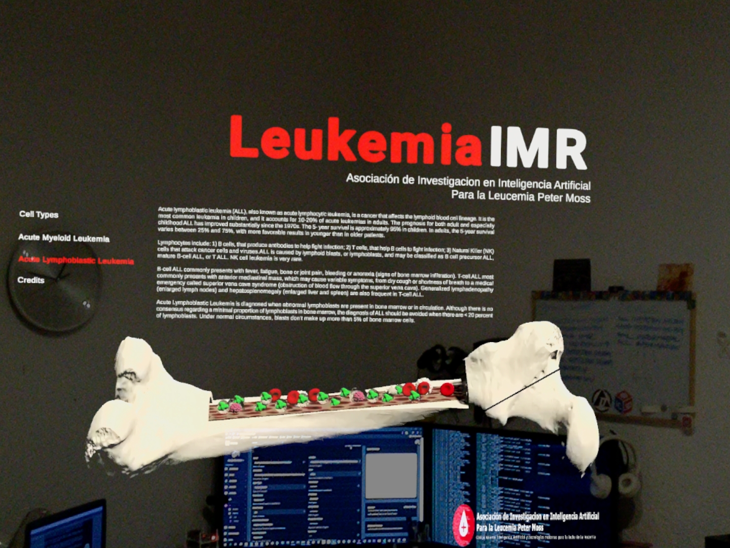 Leukemia In Mixed Reality